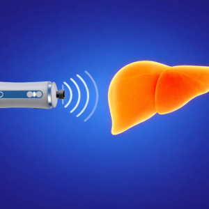 Elastografia wątroby metodą FibroScan w Bydgoszczy – teraz z możliwością rezerwacji online!